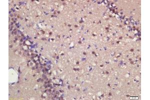 Formalin-fixed and paraffin embedded rat brain labeled with Rabbit Anti-MASH1 Polyclonal Antibody, Unconjugated  at 1:200 followed by conjugation to the secondary antibody and DAB staining (ASCL1 抗体  (AA 151-236))
