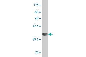 Western Blotting (WB) image for anti-Heat Shock 22kDa Protein 8 (HSPB8) (AA 97-196) antibody (ABIN565273)