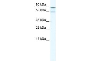 Western Blot showing PARN antibody used at a concentration of 1-2 ug/ml to detect its target protein. (PARN 抗体  (N-Term))