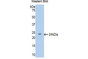 Western blot analysis of the recombinant protein. (IFNA5 抗体  (AA 22-189))