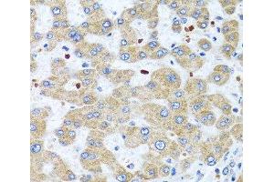Immunohistochemistry of paraffin-embedded Human liver using NMU Polyclonal Antibody at dilution of 1:100 (40x lens). (Neuromedin U 抗体)