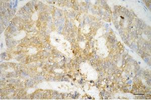 anti-Asparaginase Like 1 (ASRGL1) antibody