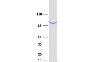 Western Blotting (WB) image for Sciellin (SCEL) (Transcript Variant 1) protein (Myc-DYKDDDDK Tag) (ABIN2731480)