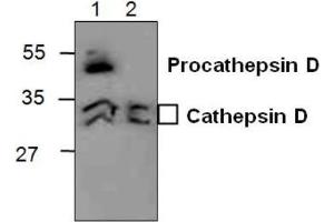 Western blot analysis of Cathepsin D in 3T3 cell lysate (Lane 1) and in Rat kidney tissue lysate (Lane 2). (Cathepsin D 抗体)