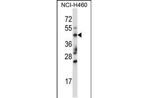 Western blot analysis in NCI-H460 cell line lysates (35ug/lane). (TRIM15 抗体  (AA 247-276))