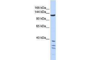 WB Suggested Anti-TNKS Antibody Titration:  1 ug/ml  Positive Control:  721_B cell lysate TNKS is strongly supported by BioGPS gene expression data to be expressed in Human 721_B cells (TNKS 抗体  (Middle Region))