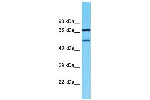 Western Blotting (WB) image for anti-Transmembrane Protein 232 (TMEM232) (N-Term) antibody (ABIN2791955) (TMEM232 抗体  (N-Term))
