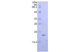 SDS-PAGE analysis of Mouse Nucleophosmin Protein. (NPM1 蛋白)
