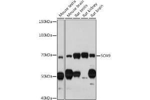 Immunohistochemistry of paraffin-embedded human thyroid cancer using SOX9 Rabbit pAb (ABIN1682861, ABIN5664083, ABIN5664085 and ABIN6219552) at dilution of 1:100 (40x lens). (SOX9 抗体  (AA 100-200))