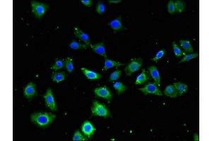 Immunofluorescent analysis of PC-3 cells using ABIN7153185 at dilution of 1:100 and Alexa Fluor 488-congugated AffiniPure Goat Anti-Rabbit IgG(H+L) (FZD4 抗体  (AA 37-222))