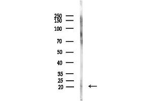 Western blot analysis of lysates from Rat brain, using Interferon alpha 2 Antibody at 1/1000 dilution.