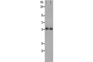 Western Blotting (WB) image for anti-Matrix Metallopeptidase 17 (Membrane-inserted) (MMP17) antibody (ABIN2426215) (MMP17 抗体)
