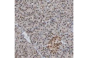 Immunohistochemical staining of human pancreas with MEIS2 polyclonal antibody  shows strong nuclear positivity at 1:200-1:500 dilution.