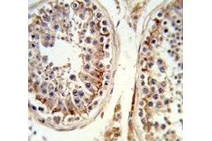 IHC analysis of FFPE human testis tissue stained with the Integrin beta 3 antibody (Integrin beta 3 抗体  (AA 734-760))