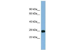 CHCHD3 antibody used at 1 ug/ml to detect target protein. (CHCHD3 抗体  (N-Term))