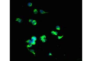 Immunofluorescent analysis of 293T cells using ABIN7170195 at dilution of 1:100 and Alexa Fluor 488-congugated AffiniPure Goat Anti-Rabbit IgG(H+L) (SLC25A4 抗体  (AA 40-102))