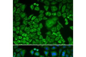 Immunofluorescence analysis of HeLa cells using ACTR3 Polyclonal Antibody (ACTR3 抗体)