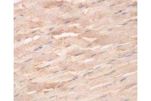 Immunohistochemical staining of formalin-fixed paraffin-embedded human skeletal muscle tissue showing cytoplasmic staining with CNTF polyclonal antibody  at 1 : 100 dilution. (CNTF 抗体  (N-Term))