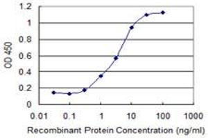 Detection limit for recombinant GST tagged PRKCD is 0. (PKC delta 抗体  (AA 577-676))