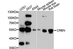 Western blot analysis of extracts of various cell lines, using CRBN antibody. (CRBN 抗体)