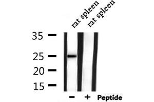 Western blot analysis of extracts from rat spleen, using CACNG1 Antibody. (CACNG1 抗体  (Internal Region))