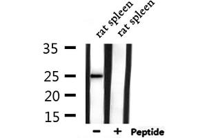 Western blot analysis of extracts from rat spleen, using CACNG1 Antibody.