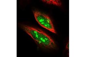 Immunofluorescent staining of human cell line U-2 OS with SDAD1 polyclonal antibody  at 1-4 ug/mL dilution shows positivity in nucleus and nucleoli. (SDAD1 抗体)