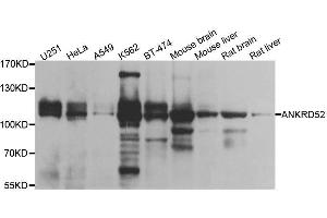 Western blot analysis of extracts of various cell lines, using ANKRD52 antibody. (ANKRD52 抗体  (AA 450-660))