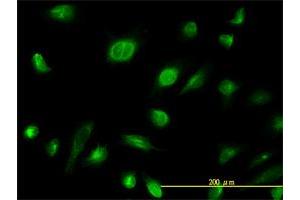 Immunofluorescence (IF) image for anti-Adenylate Kinase 1 (AK1) (AA 1-194) antibody (ABIN559821)