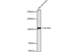 Western blot analysis of extracts of Mouse brain , using SLC8 antibody (ABIN6132664, ABIN6148050, ABIN6148052 and ABIN6221228) at 1:5000 dilution. (SLC8A1 抗体  (AA 250-520))