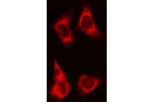 ABIN6266780 staining HeLa cells by IF/ICC.
