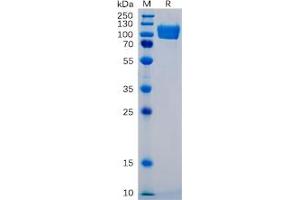 Human ICAM-1 Protein, mFc Tag on SDS-PAGE under reducing condition. (ICAM1 Protein (mFc Tag))