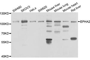 Western blot analysis of extracts of various cell lines, using EPHA2 antibody. (EPH Receptor A2 抗体)