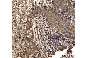 IHC analysis of delta 1 Catenin/CAS/CTNND1 using anti-delta 1 Catenin/CAS/CTNND1 antibody (ABIN7602221).