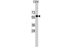 Western blot analysis of CNOT4 polyclonal antibody  in CEM cell line lysates (35 ug/lane). (CNOT4 抗体  (C-Term))