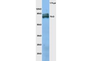 Mouse skeletal muscle lysate probed with Anti TXLNB Polyclonal Antibody, Unconjugated (ABIN1386717) at 1:200 overnight at 4 °C. (Taxilin beta 抗体  (AA 331-430))