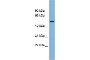 WB Suggested Anti-C2orf29 Antibody Titration: 0. (CNOT11 抗体  (N-Term))