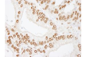 Immunohistochemistry (IHC) image for anti-cAMP Responsive Element Binding Protein 1 (CREB1) (AA 250-300) antibody (ABIN7448947) (CREB1 抗体  (AA 250-300))