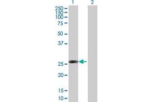 Western Blotting (WB) image for anti-Adenylate Kinase 3 (AK3) (AA 1-227) antibody (ABIN526335)
