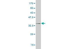 Western Blot detection against Immunogen (34. (HAND2 抗体  (AA 135-216))