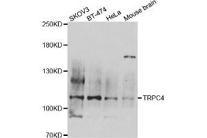 Western blot analysis of extracts of various cell lines, using TRPC4 antibody. (TRPC4 抗体)
