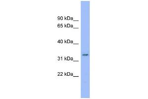 WB Suggested Anti-C20orf116 Antibody Titration:  0. (DDRGK1 抗体  (Middle Region))