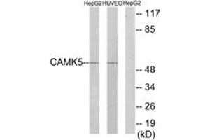 Western blot analysis of extracts from HepG2/HuvEc cells, using CAMK5 Antibody. (CAMKV 抗体  (AA 211-260))