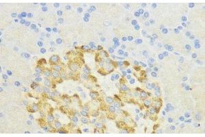 Immunohistochemistry of paraffin-embedded Rat pancreatic islet using SURF4 Polyclonal Antibody at dilution of 1:200 (40x lens). (Surfeit 4 抗体)