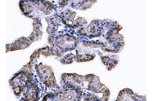 IHC analysis of Tspan-8/Tspan8 using anti-Tspan-8/Tspan8 antibody (ABIN7599681). (Tspan-8 抗体  (AA 108-203))