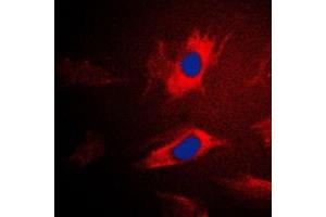 Immunofluorescent analysis of IARS2 staining in Jurkat cells. (IARS2 抗体  (N-Term))