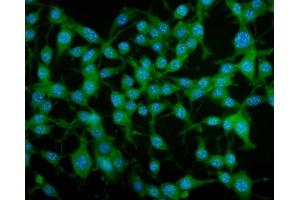IF analysis of PAR4/Pawr using anti-PAR4/Pawr antibody (ABIN7599938).