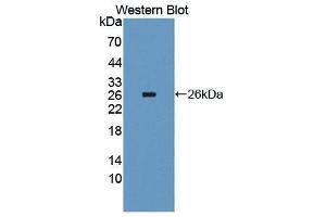 Western Blotting (WB) image for anti-Interleukin 4 Receptor (IL4R) antibody (Biotin) (ABIN1175405) (IL4 Receptor 抗体  (Biotin))