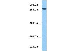Host:  Rabbit  Target Name:  PTPRN  Sample Tissue:  Human Liver Tumor  Antibody Dilution:  1ug/ml (PTPRN 抗体  (Middle Region))