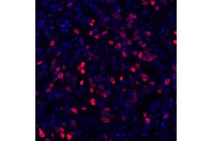 Immunofluorescence (IF) image for anti-Antigen Identified By Monoclonal Antibody Ki-67 (MKI67) (AA 1200-1250) antibody (ABIN7449552) (Recombinant Ki-67 抗体  (AA 1200-1250))